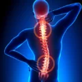 Bol u donjem delu leđa: Uzroci i rešenja