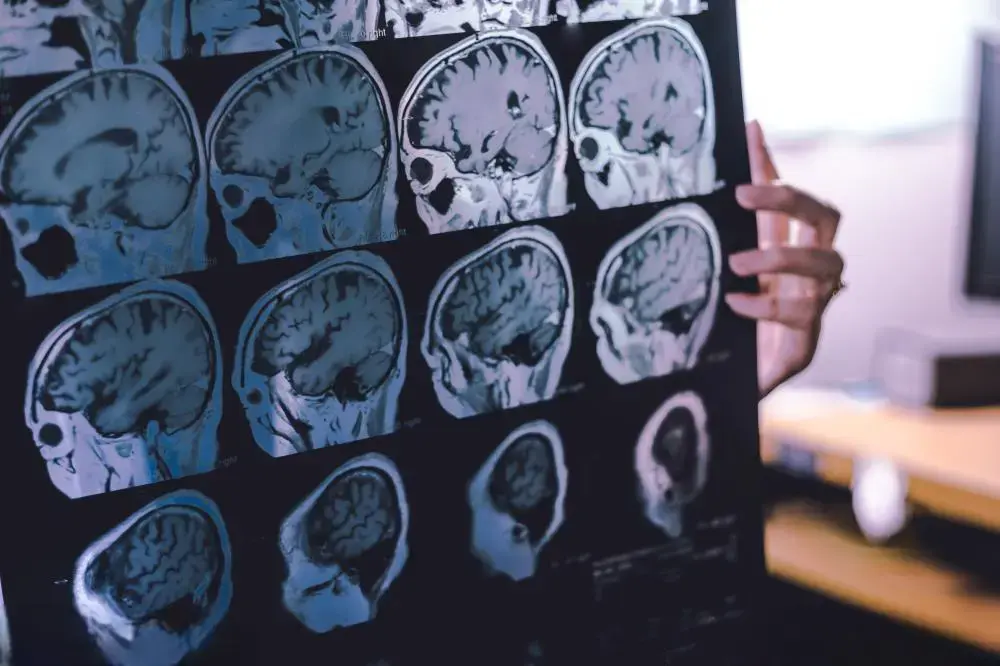 Prevencija demencije i Alchajmera: ključne promene načina života