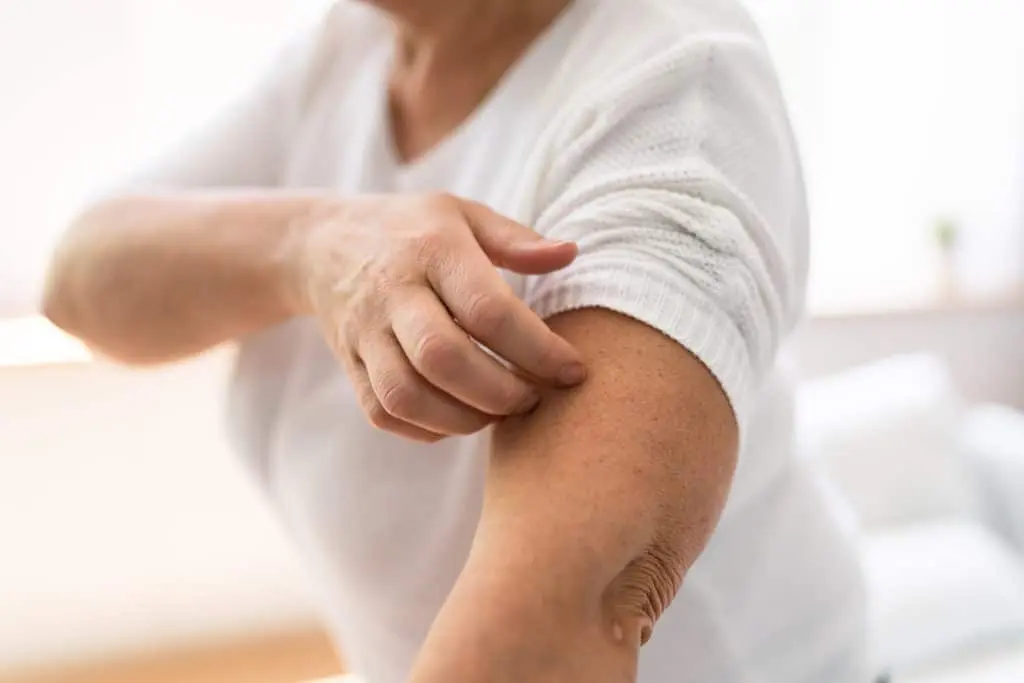 Šta je alodinija? Simptomi, uzroci i terapija